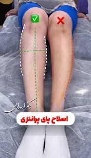 فیلر بادی