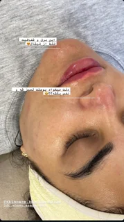 فیشال